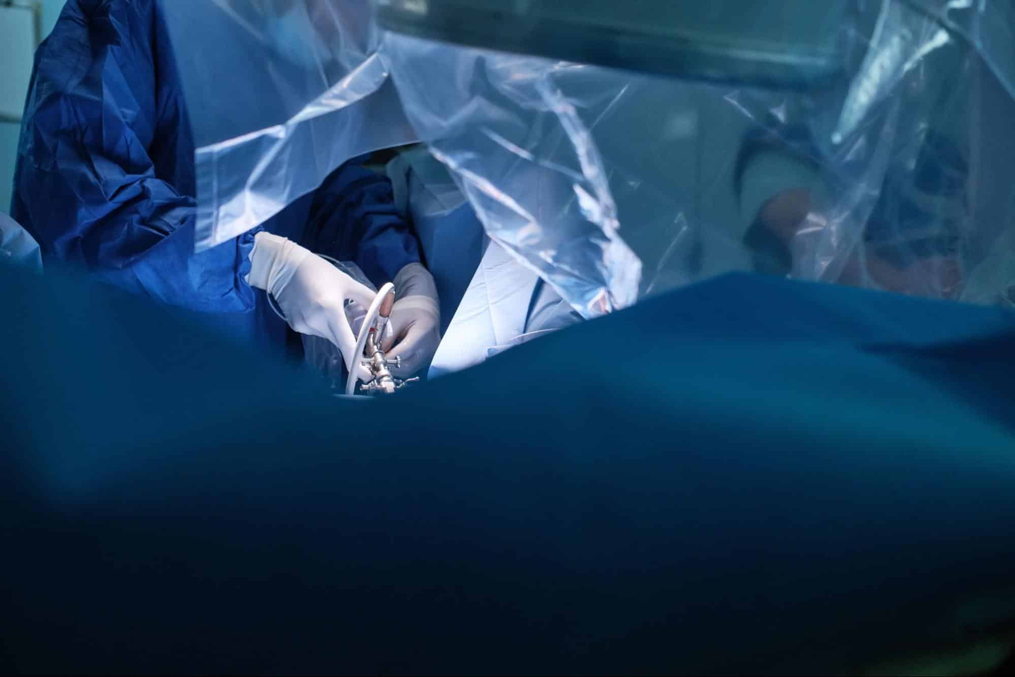 laparoscopia urologica