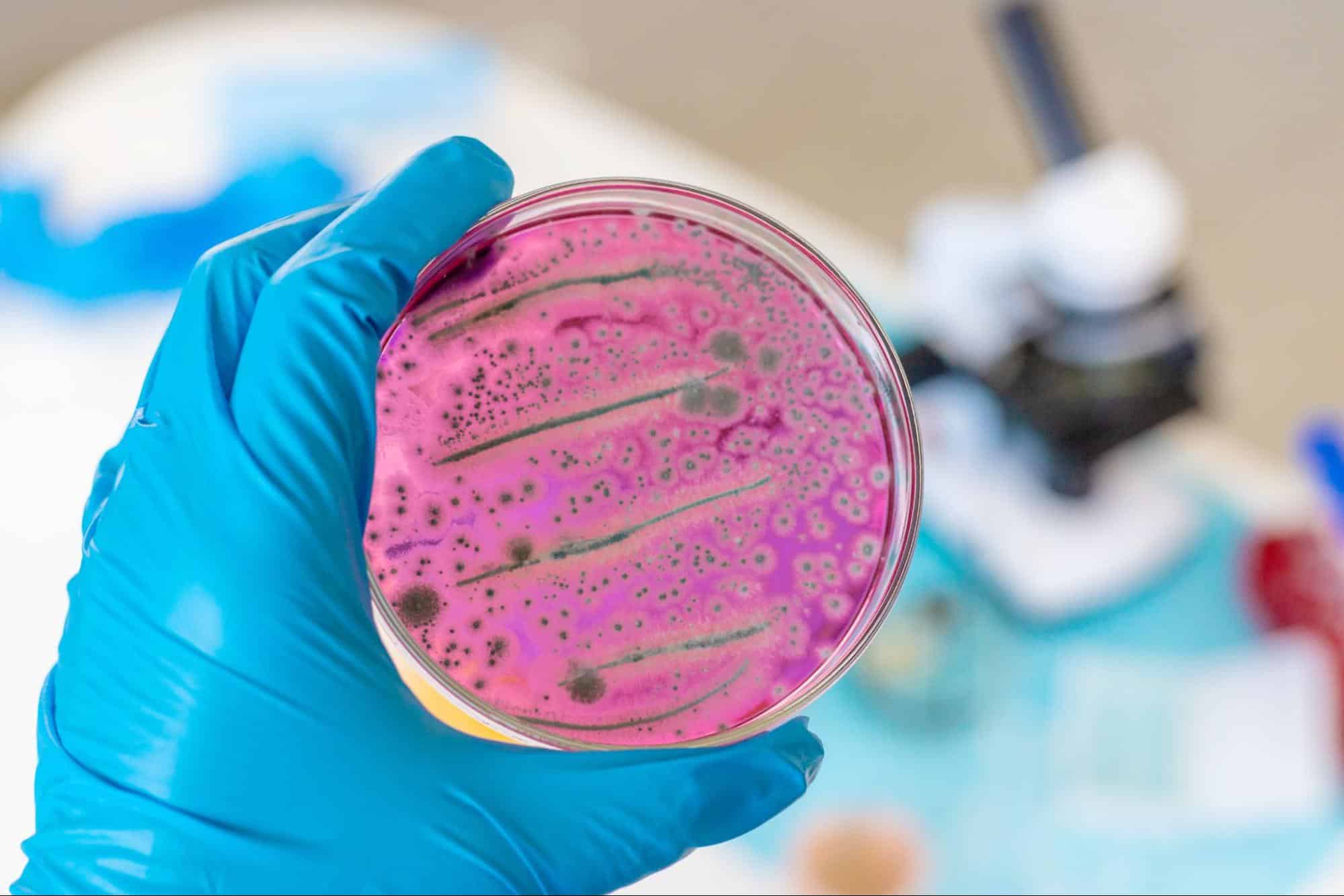 antibioticos para prostatitis aguda bacteriana