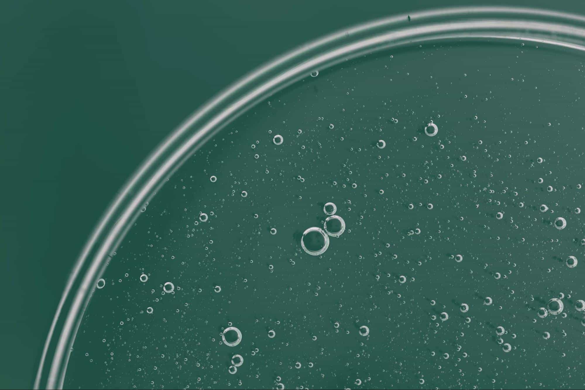 prostatitis bacteriana aguda